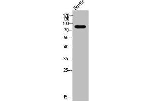 Western Blot analysis of HuvEC cells using DGK-β Polyclonal Antibody (DGKB antibody  (C-Term))