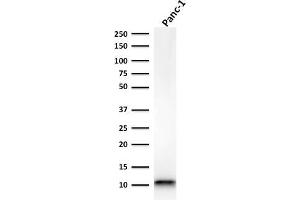 Western Blot Analysis of Panc-1 cell lysate using S100A4 Recombinant Mouse Monoclonal Antibody (rS100A4/1481).