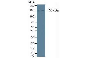 Figure. (Phospholipase C beta 3, Phosphoinositide Specific (AA 318-468) antibody)