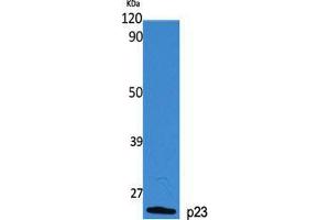 Western Blot (WB) analysis of specific cells using p23 Polyclonal Antibody. (CDK5R1 antibody  (Tyr579))