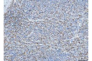 IHC analysis of FHL2 using anti-FHL2 antibody (ABIN7600782). (FHL2 antibody  (AA 234-279))