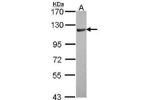 WB Image Sample (30 ug of whole cell lysate) A: JurKat 7. (ARHGAP4 antibody  (N-Term))