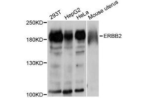 Western blot analysis of extracts of various cell lines, using ErbB2 antibody. (ErbB2/Her2 antibody  (C-Term))