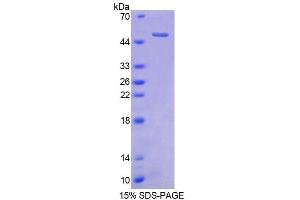 SDS-PAGE (SDS) image for Cerebellin 1 Precursor (CBLN1) (AA 22-193) protein (His tag,GST tag) (ABIN6237156) (CBLN1 Protein (AA 22-193) (His tag,GST tag))
