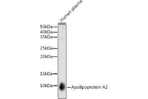 Western blot analysis of extracts of Human plasma cells, using Apolipoprotein  antibody (ABIN1682269, ABIN3017693, ABIN3017694 and ABIN7101521) at 1:1000 dilution.