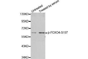 Western blot analysis of extracts from 293 cells using phospho-FOXO4-S197 antibody (ABIN2987524). (FOXO4 antibody  (pSer197))