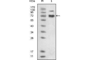 Western blot analysis using EphB4 mouse mAb against extracellular domain of human EphB4 (aa16-539). (EPH Receptor B4 antibody)