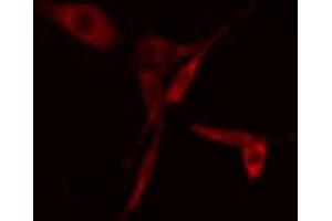 ABIN6268840 staining A549 cells by IF/ICC. (CCR7 antibody  (Internal Region))