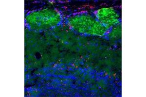 Immunofluorescence (IF) image for anti-Nerve Growth Factor Receptor (NGFR) antibody (ABIN350707)