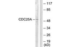 Western Blotting (WB) image for anti-Cell Division Cycle 25 Homolog A (S. Pombe) (CDC25A) (AA 90-139) antibody (ABIN2888800) (CDC25A antibody  (AA 90-139))
