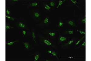 Immunofluorescence of purified MaxPab antibody to DUSP4 on HeLa cell. (DUSP4 antibody  (AA 1-394))