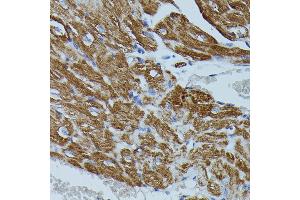 Immunohistochemistry (IHC) image for anti-FK506 Binding Protein 1B, 12.6 KDa (FKBP1B) (AA 1-80) antibody (ABIN7267212)