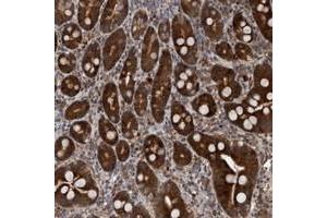 Immunohistochemical staining of human duodenum with TANC2 polyclonal antibody  strong cytoplasmic positivity in glandular cells.