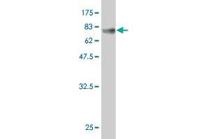 Western Blot detection against Immunogen (65. (NOV antibody  (AA 1-357))