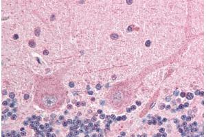 Human Brain, Cerebellum (formalin-fixed, paraffin-embedded) stained with ING4 antibody ABIN292976 at 2. (ING4 antibody  (AA 164-175))