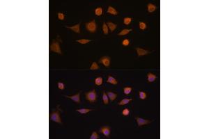 Immunofluorescence analysis of L929 cells using GST Rabbit pAb (8266) at dilution of 1:100 (40x lens). (GSTA1 antibody  (AA 1-222))