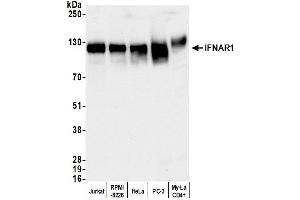 Western Blotting (WB) image for anti-Interferon alpha/beta Receptor 1 (IFNAR1) (AA 507-557) antibody (ABIN7449753)