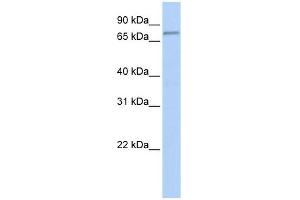 FBXO42 antibody used at 1 ug/ml to detect target protein. (FBXO42 antibody  (Middle Region))