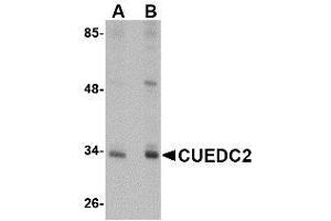 Western blot analysis of CUEDC2 in HeLa cell lysate with AP30262PU-N CUEDC2 antibody at (A) 1 and (B) 2 μg/ml. (CUEDC2 antibody  (C-Term))