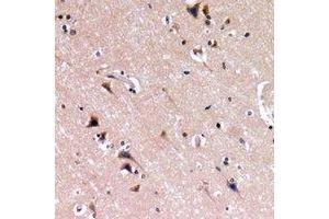 Immunohistochemical analysis of Nephrin staining in human brain formalin fixed paraffin embedded tissue section.