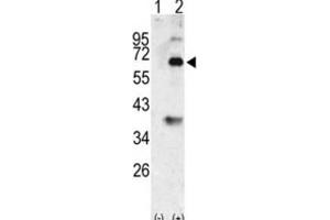 Western Blotting (WB) image for anti-Bone Morphogenetic Protein 3 (BMP3) antibody (ABIN2999248)
