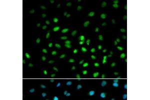 Immunofluorescence analysis of MCF-7 cells using LKB1 Polyclonal Antibody (LKB1 antibody)