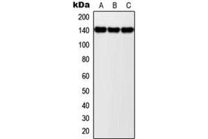 Western blot analysis of NOLC1 expression in MCF7 (A), SP2/0 (B), PC12 (C) whole cell lysates. (NOLC1 antibody  (C-Term))