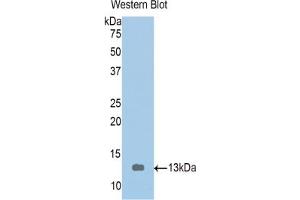 Western blot analysis of the recombinant protein. (Tropomodulin 1 antibody  (AA 39-138))