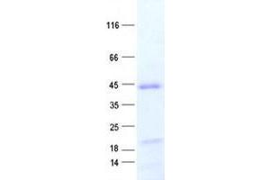 ZNF707 Protein (His tag)