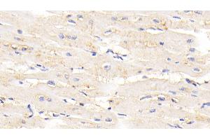 Detection of TTN in Human Cardiac Muscle Tissue using Polyclonal Antibody to Titin (TTN) (Titin antibody  (AA 33779-34025))
