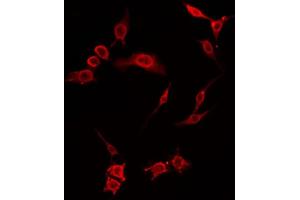 ABIN6274413 staining COLO205 by IF/ICC. (MOBKL2B antibody  (C-Term))