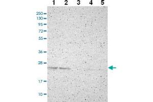 Western blot analysis of Lane 1: RT-4 Lane 2: U-251 MG Lane 3: Human Plasma Lane 4: Liver Lane 5: Tonsil with PDDC1 polyclonal antibody ( Cat # PAB28008 ) at 1:100 - 1:250 dilution. (PDDC1 antibody)