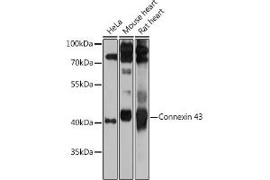Western blot analysis of extracts of various cell lines, using Connexin 43 antibody (ABIN6131701, ABIN6141098, ABIN6141099 and ABIN6215448) at 1:1000 dilution. (Connexin 43/GJA1 antibody  (AA 233-382))