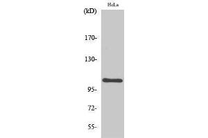 Western Blotting (WB) image for anti-Nuclear Factor of kappa Light Polypeptide Gene Enhancer in B-Cells 1 (NFKB1) (Thr147) antibody (ABIN3185879) (NFKB1 antibody  (Thr147))