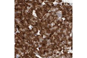 Immunohistochemical staining of human pancreas with ZNF341 polyclonal antibody  shows strong cytoplasmic positivity in exocrine cells at 1:200-1:500 dilution.
