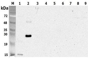 Western blot analysis using anti-CTRP5 (human), pAb  at 1:5'000 dilution. (CTRP5 antibody)