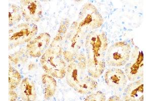 Immunohistochemistry of paraffin-embedded rat kidney using GCLC Rabbit mAb (ABIN1680604, ABIN3018993, ABIN3018994 and ABIN7101696) at dilution of 1:100 (40x lens). (GCLC antibody)