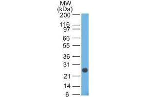 Western Blot analysis of human intestinal lysate using Lambda Light Chain Mouse Monoclonal Antibody (HP6054). (IgL antibody)