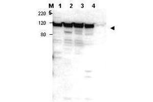 Western blot using  affinity purified anti-Myosin 1G antibody shows detection of a band ~100 kDa in size corresponding to Myosin 1G (arrowhead) in Myosin 1G positive whole cell lysate - lane 1 Jurkat, lane 2 peripheral blood T cells, lane 3 human spleen and lane 4 300. (MYO1G antibody  (Internal Region))