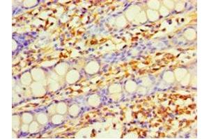 Immunohistochemistry of paraffin-embedded human colon tissue using ABIN7149619 at dilution of 1:100 (DHRS7 antibody  (AA 29-339))
