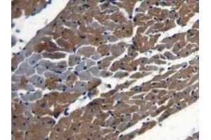 DAB staining on IHC-P; Samples: Rat Heart Tissue (NCOA3 antibody  (AA 1-269))