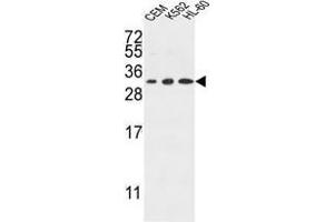 TSPAN2 Antibody (Center) western blot analysis in CEM,K562,HL-60 cell line lysates (35 µg/lane). (Tetraspanin 2 antibody  (Middle Region))