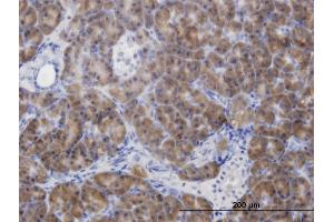 Immunoperoxidase of monoclonal antibody to CBS on formalin-fixed paraffin-embedded human pancreas. (CBS antibody  (AA 1-100))