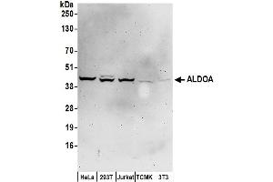 Western Blotting (WB) image for anti-Aldolase A, Fructose-Bisphosphate (ALDOA) (AA 325-375) antibody (ABIN7449955)