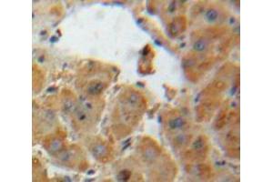 Used in DAB staining on fromalin fixed paraffin-embedded Liver tissue (AGT antibody  (AA 25-477))