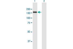 SMARCAD1 antibody  (AA 1-1028)