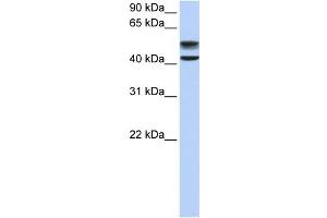 WB Suggested Anti-GNS Antibody Titration:  0. (GNS antibody  (C-Term))