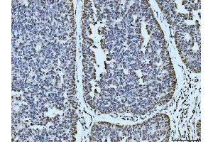 IHC analysis of 53BP1/TP53BP1 using anti-53BP1/TP53BP1 antibody (ABIN7599869).