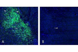 anti-Lysophosphatidic Acid Receptor 6 (LPAR6) (2nd Extracellular Loop), (AA 156-168) antibody
