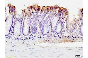 Formalin-fixed and paraffin embedded mouse intestine labeled with Anti-SUMO 1 Polyclonal Antibody, Unconjugated (ABIN687397) at 1:200 followed by conjugation to the secondary antibody and DAB staining. (SUMO1 antibody  (AA 21-101))